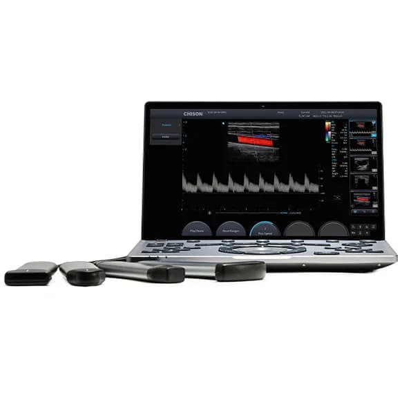 SonoAir 60 — УЗИ-система в формате ноутбука