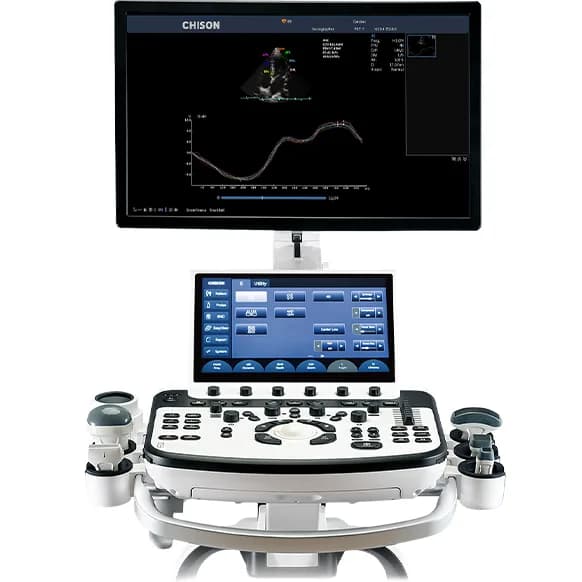 XBit 90 — Premium ultratovush tizimi
