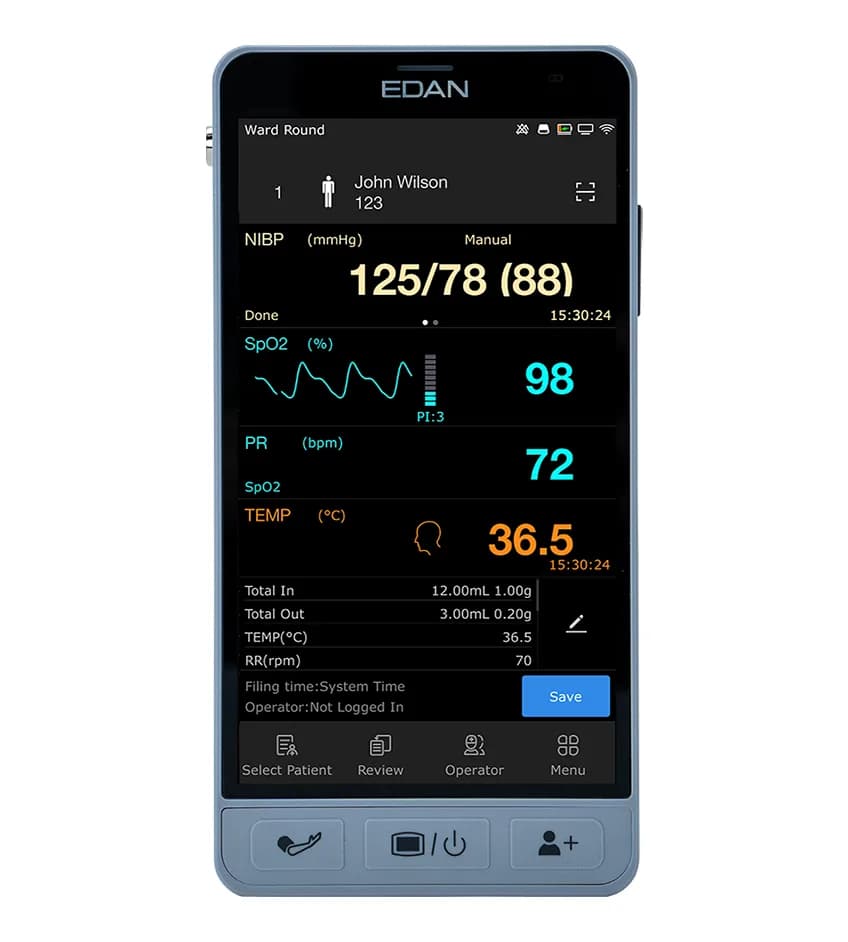 iM3s Vital Signs Monitor — Ko'p parametrli bemor monitori