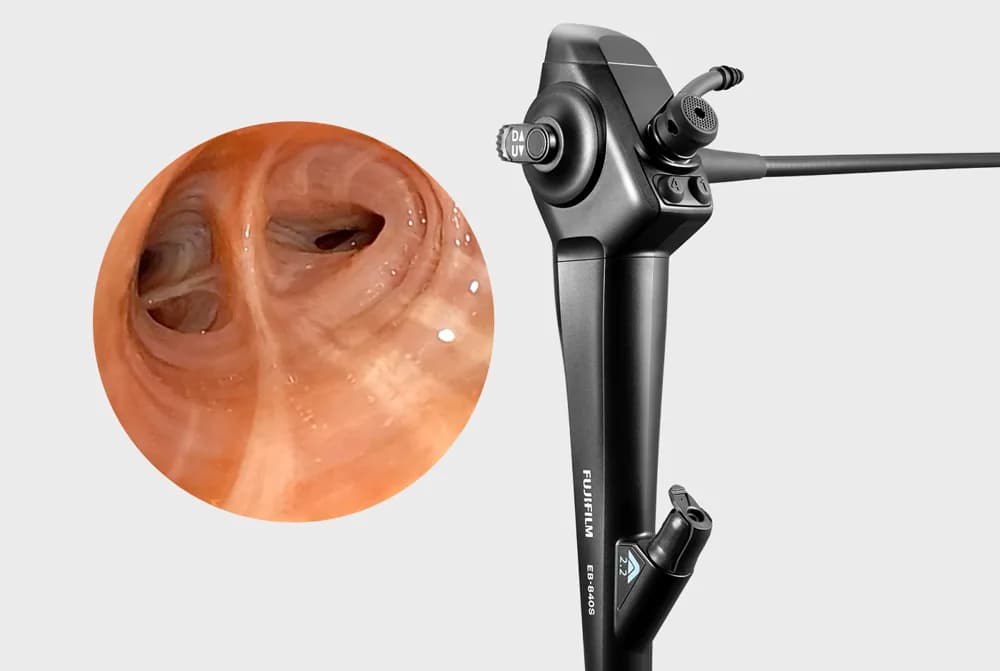 Fujifilm Bronchoscopes — Bronxoskoplar