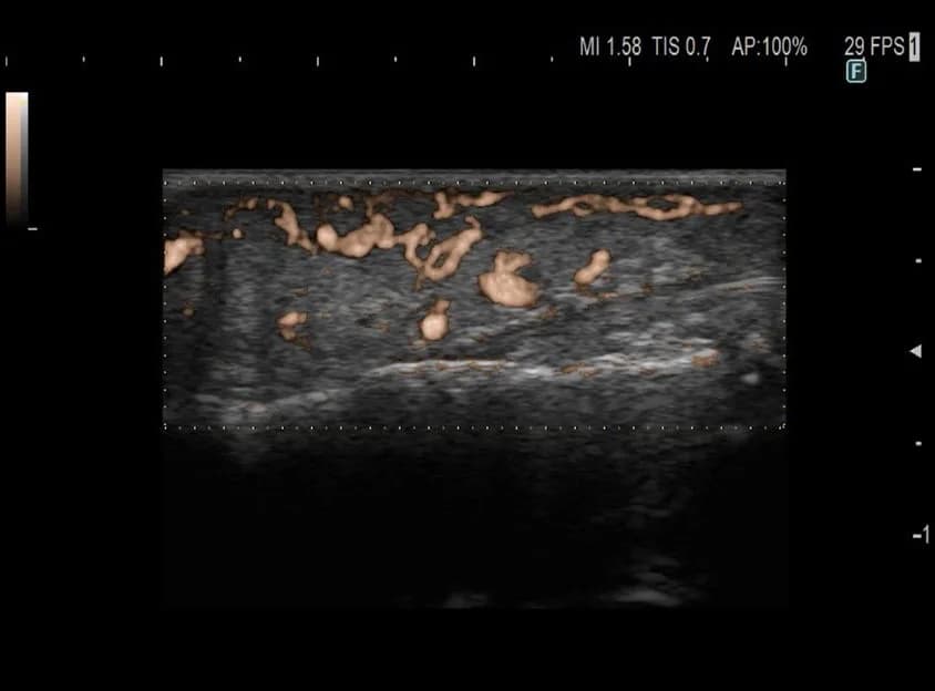 ARIETTA 850 Endoscopic Ultrasound — Ultratovush tizimi