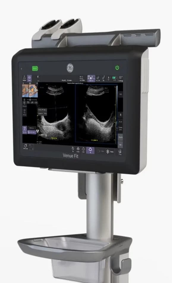 Venue Point of Care Ultrasound for Perioperative Anesthesia — Ultratovush tizimi