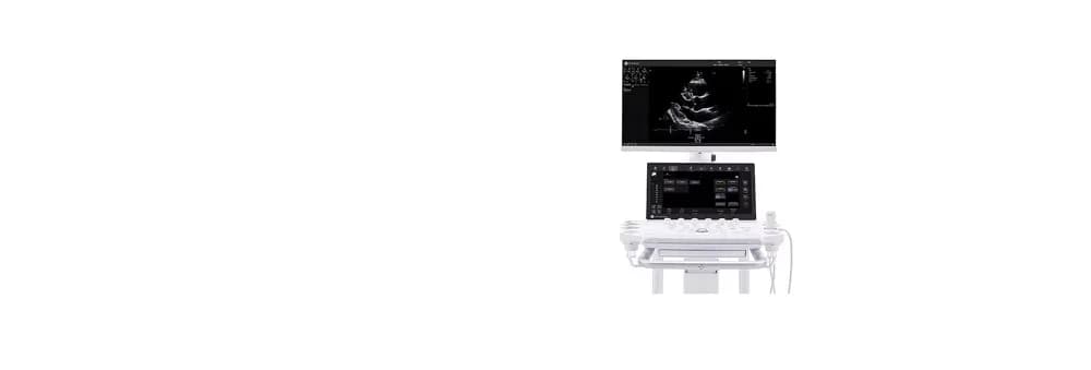 Vivid Advanced — Ultratovush tizimi