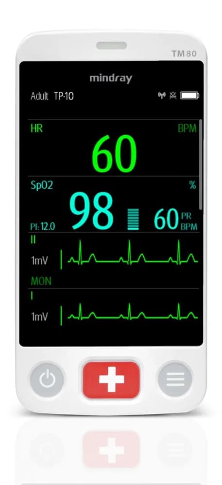 BeneVision TM80 — Bemor monitori