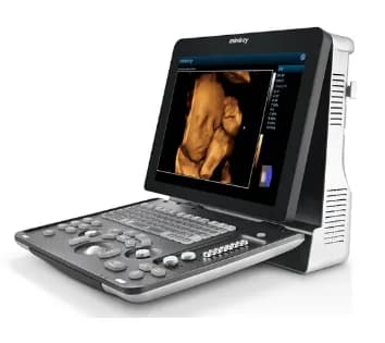 Z60 — Ultratovush tizimi
