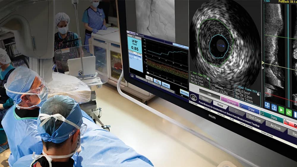 Philips Core precision guided therapy system — Система терапии под контролем изображений