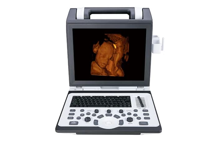 Apogee 2100 — Rangli doppler ultratovush tizimi