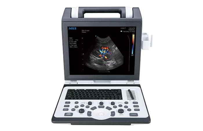 Apogee 2100V — Veterinariya portativ ultratovush tizimi