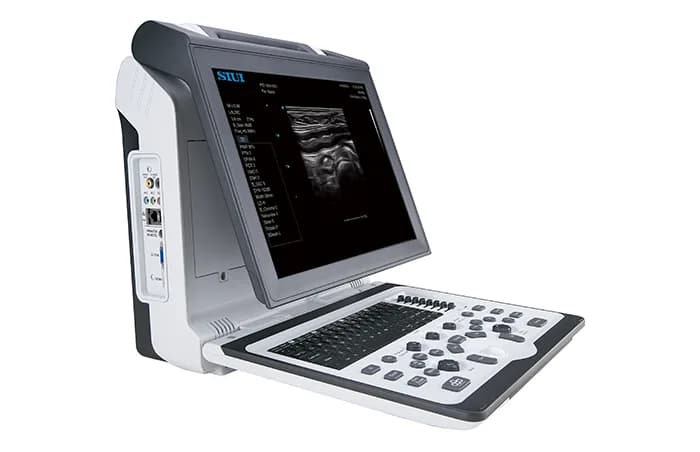 Apogee 2300V — Veterinariya portativ ultratovush tizimi