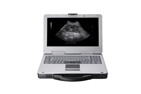 V3 — Veterinariya portativ ultratovush tizimi
