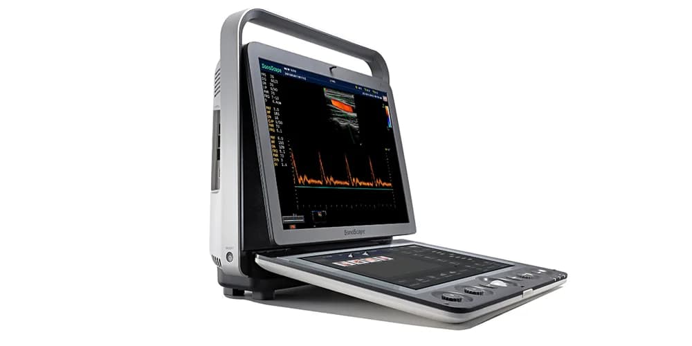 S9 — Портативная ультразвуковая система