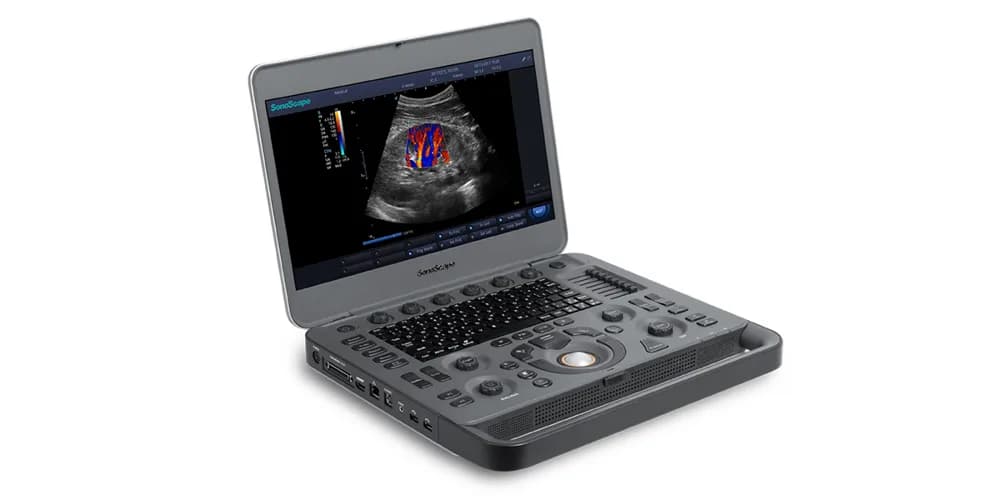 X3 — Portativ ultratovush tizimi