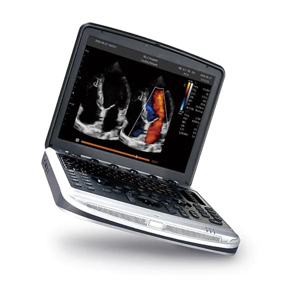 SonoBook 7 — Noutbuk turidagi ultratovush