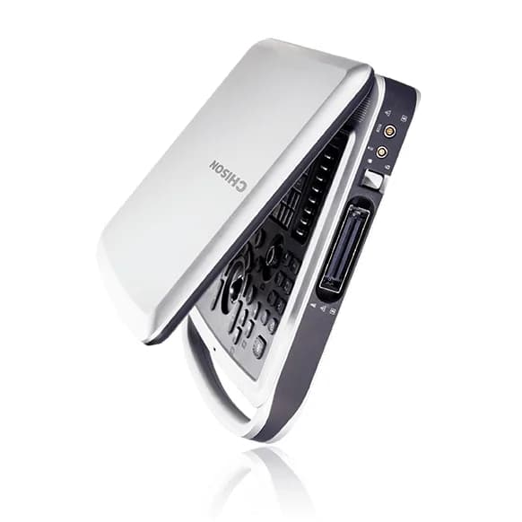 SonoBook 9 — Noutbuk turidagi ultratovush