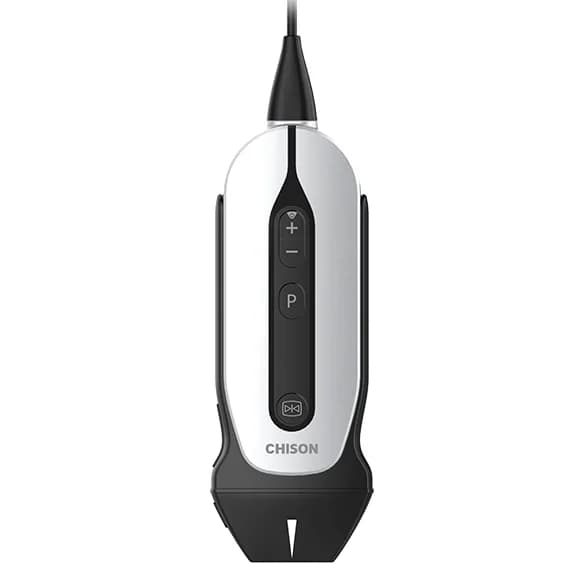 SonoEye P1 — Ultratovush datchigi