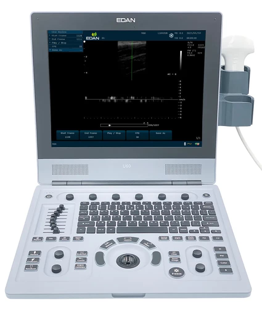 U60 Diagnostic Ultrasound System — Ultratovush tizimi