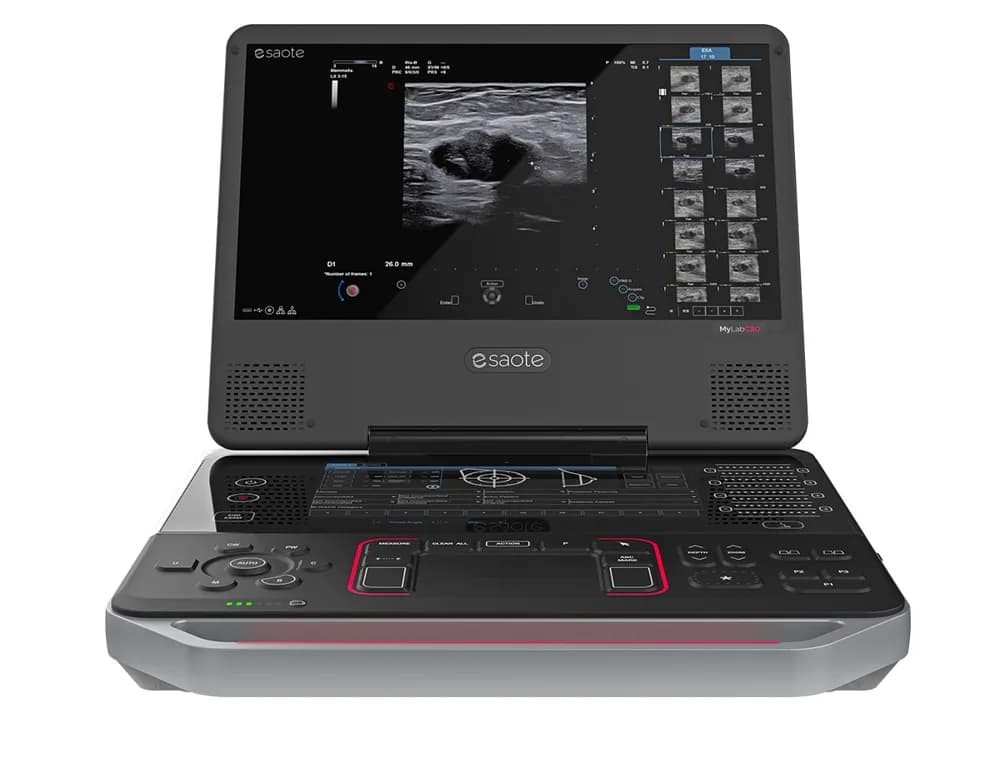 Esaote MyLab C30 — Ультразвуковая система