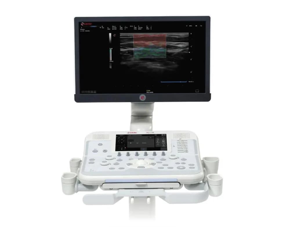 Esaote MyLab X6 — Ультразвуковая система
