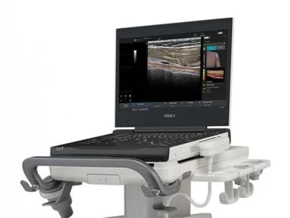 LOGIQ e X Ultrasound — Ультразвуковая система