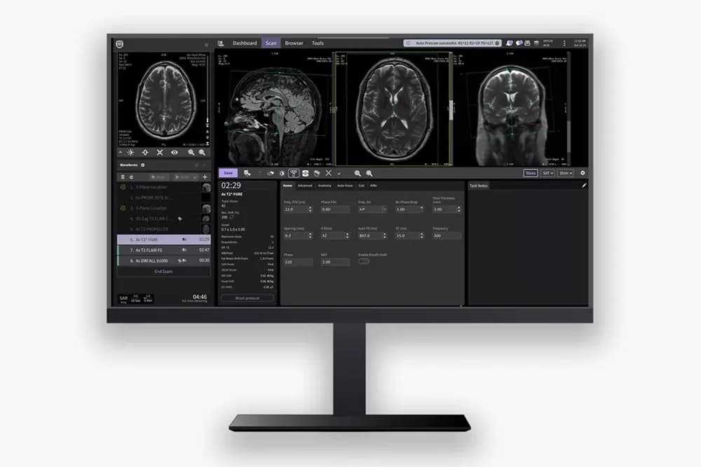 SIGNA Bolt–3T wide bore MRI delivering power with purpose — Magnit-rezonans tomograf