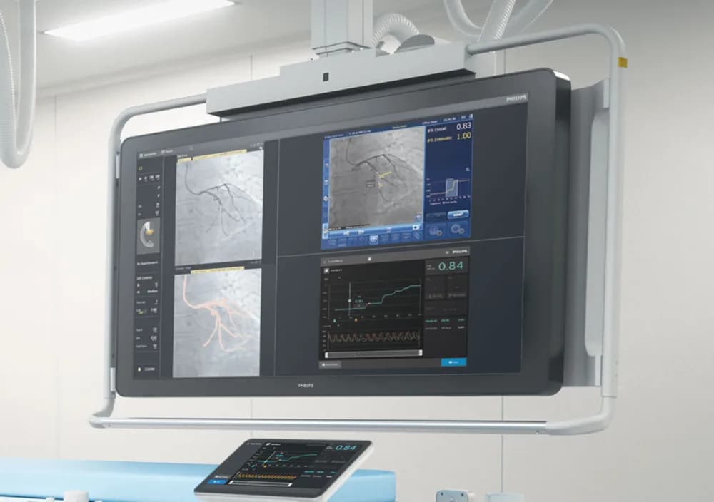 Philips SyncVision precision guidance system — Система терапии под контролем изображений