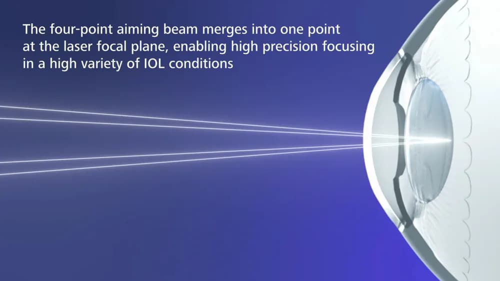 ZEISS VISULAS yag — Terapevtik lazer